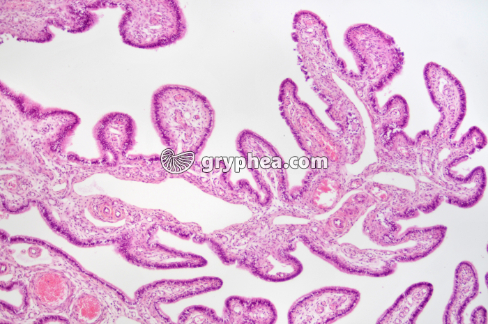 Trompe de Fallope x25 - gryphea.com